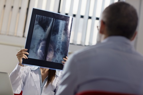 Рентген желудка с барием: подготовка, как делают, что показывает?