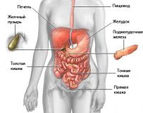 Особенности течения канцероматоза брюшной полости