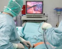 Процедура гастроскопии желудка