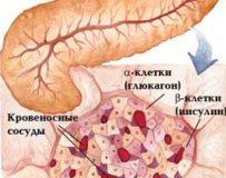 Способы лечения панкреонекроза поджелудочной железы