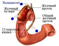 Методика лечения хронического холецистита