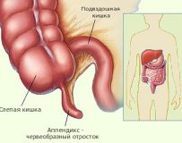 Местонахождение, функции и болезни аппендикса