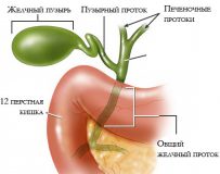 Специфика лечения бескаменного холецистита