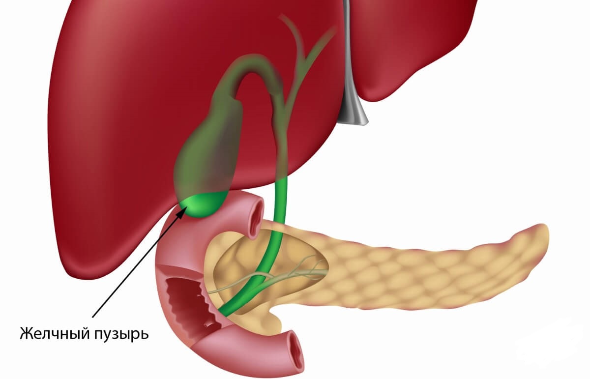 Болят желчные протоки. Желчный пузырь картинка. Резекция протока желчного пузыря. Патология печени и желчевыводящей системы.