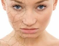 Появление пятен на коже при заболеваниях поджелудочной железы