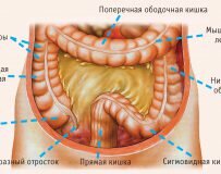 Лечение и прогноз при каловом перитоните