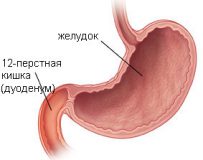 Симптомы и лечение поверхностного дуоденита