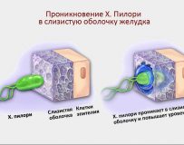 Какие симптомы заболеваний двенадцатиперстной кишки?