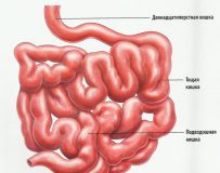 Заболевание раком тонкого кишечника — признаки и симптомы