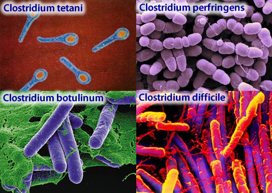 Бактерия клостридия