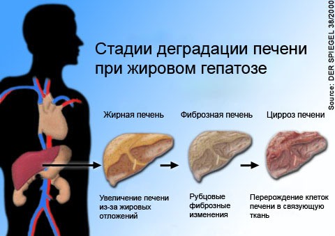 Стадии деградации пораженного органа