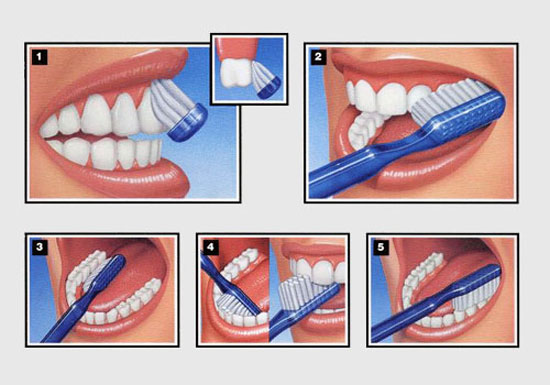 Техника чистки зубов
